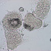 Mikroskopbild på Echinococcus (blåsmask) protoscolices.