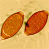 Mikroskopbild på Trichuris trichiura (piskmask), ägg.