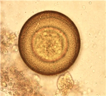 Bild på Hymenolepis diminuta (råttbinnikemask), ägg.
