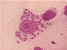 Bild på Leishmania-infekterad makrofag.