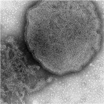 Bild på Paramyxovirus (parainfluensa).