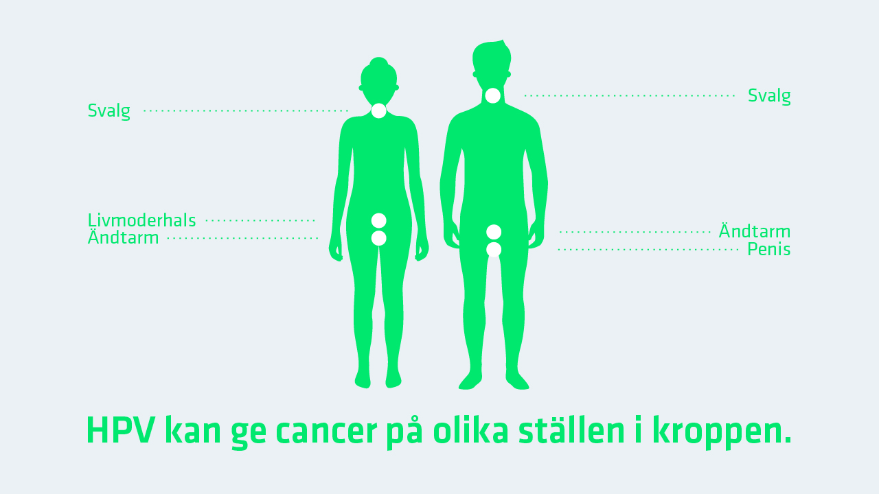HPV kan ge cancer på olika ställen i kroppen, svalg, livmoderhals, ändtarm och penis.