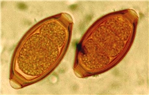 Bild på Trichuris trichiura (piskmask), ägg. 