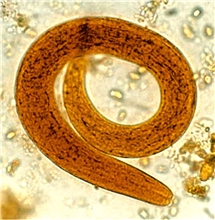 Bild på Strongyloides stercoralis, larv. 