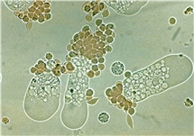 Bild på Entamoeba histolytica trofozoiter.