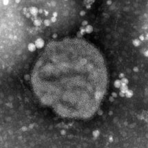 Bilden visar ett lågpatogent virus (H5N2)  preparerat från hönsägg.