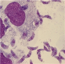 Bild på Toxoplasma gondii tachyzoiter. 