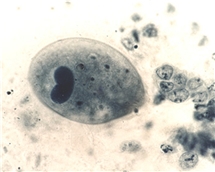 Bild på Balantidium coli trofozoit.