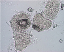 Echinococcus (blåsmask) protoscolices. Foto: Marianne Lebbad, Folkhälsomyndigheten