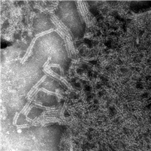 Bild på Paramyxovirus (påssjuka). 