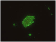 Bild på Pneumocystis jirovecii cystklase färgad med en monoklonal antikropp. 