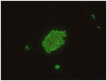 Bild på Pneumocystis jirovecii cystklase färgad med en monoklonal antikropp. 