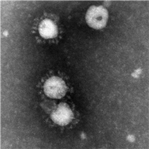 Bild på Coronavirus (SARS). 