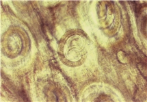 Bild på Trichinella spiralis (trikin), muskelcystor. 