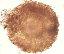 Bild på mögelsvamp Aspergillus.