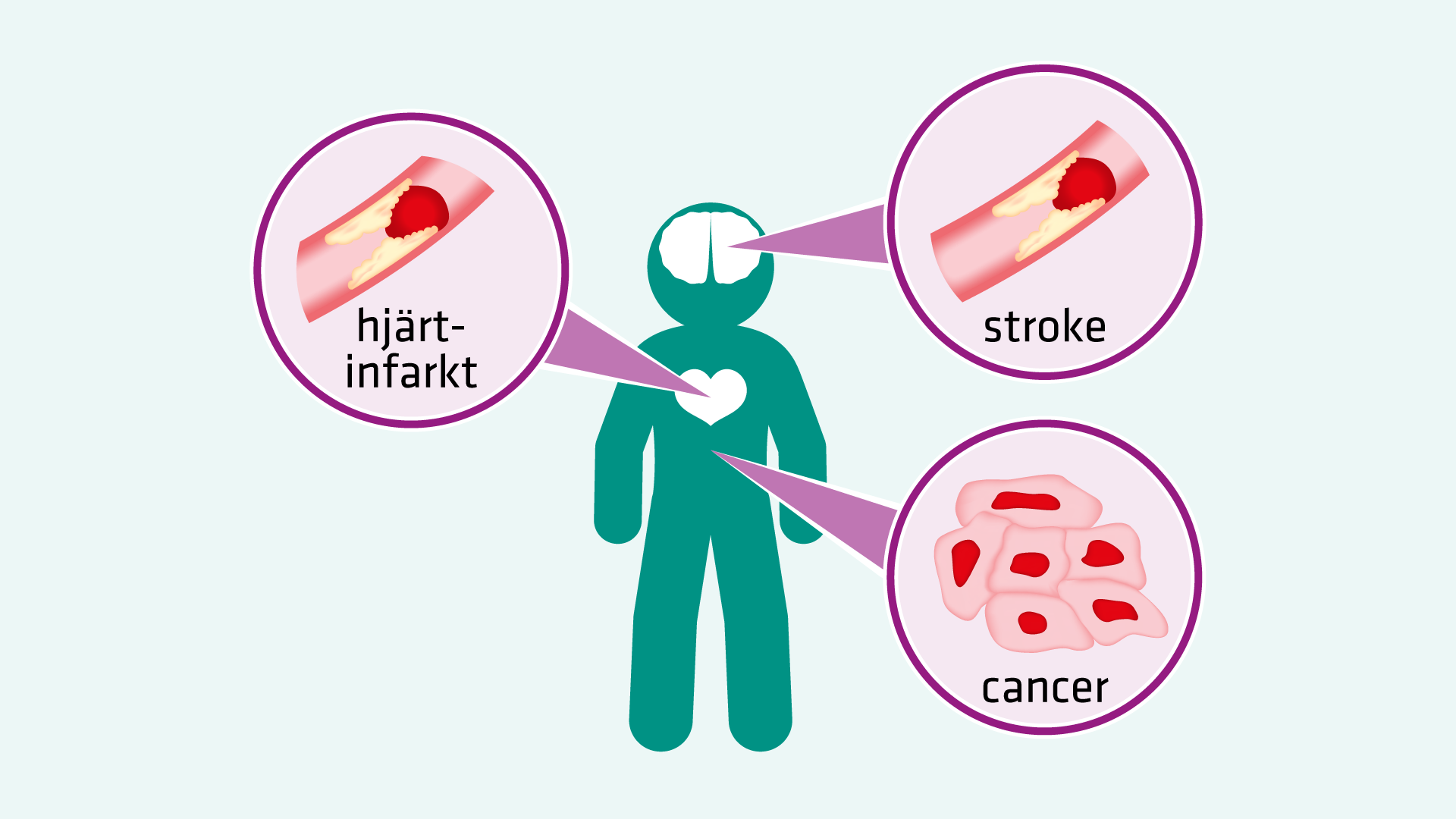 Illustration av en person med pilar till stroke, hjärtinfarkt och cancer.