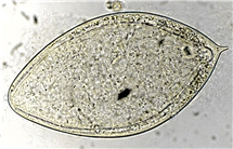Bild på Schistosoma haematobium, ägg