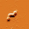 Mikroskopbild på Helicobacter pylori.