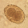 Mikroskopbild på Ascaris (spolmask), ägg.