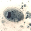 Mikroskopbild på Balantidium coli trofozoit