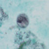 Mikroskopbild på Entamoeba histolytica/dispar cysta.