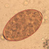 Mikroskopbild på Fasciola (leverflundra), ägg.