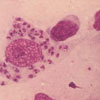 Mikroskopbild på Leishmania-infekterad makrofag.