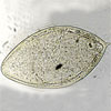 Mikroskopbild på Schistosoma haematobium, ägg.