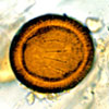Mikroskopbild på Taenia, ägg.