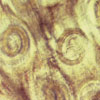 Mikroskopbild på Trichinella spiralis (trikin), muskelcystor.