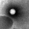 Mikroskopbild på Adenovirus (barndiarré).