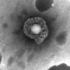 Mikroskopbild på herpes simplex typ 1 (från munsår).