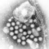 Mikroskopbild på norovirus (vinterkräksjuka).