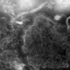 Mikroskopbild på paramyxovirus (mässling).