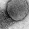 Mikroskopbild på paramyxovirus (parainfluensa).
