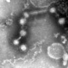 Mikroskopbild på respiratory syncytial virus (RS-virus).