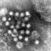 Mikroskopbild på sapovirus (barndiarré).