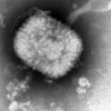 Mikroskopbild på vaccinia (vaccin mot smittkoppor).